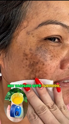 790K views · 6K reactions | Mix Vaseline With Turmeric ~ The Secret Nobody Will Ever Tell You ~ Thank Me Later ! #glowingskin #antiaging #skincare #fypシ゚viralシfypシ゚viralシalシ #fbreelsfypシ゚viral #fbreelsvideo #fbreelsfypシ゚viralvideo #explorepage #fblifestyle | Bright Star | Facebook