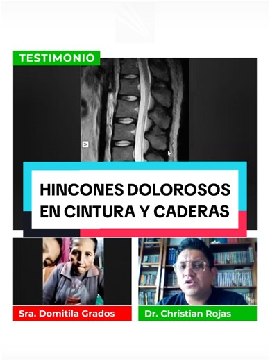 HINCONES DOLOROSOS EN CINTURA Y CADERAS. Testimonio de la Sra. Domitila Grados, quien llegó desde CERRO DE PASCO a tratarse en nuestra Sede LIMA. Encuentra en nuestra página web testimonios de pacientes recuperados, que incluye además el agradecimiento de #médicos y #enfermeras de todo el Perú: www.medilaserperu.com.pe/testimonios #Laser #Artrosis #Hernia Créditos de fondo musical para este video: WARM CLOUDS by ChrisGerárdMusic (GYA RECORDS)
