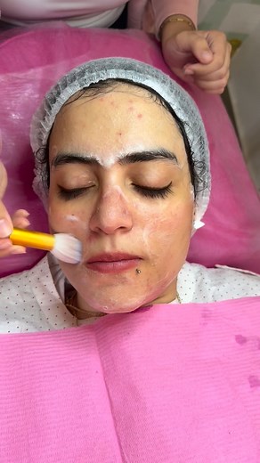 ✨ Tips for a stronger skin barrier & clearer skin ✨ • حافظي على...