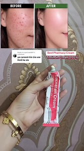 Tretinoin Tracnesan 0.05% Cream Review
