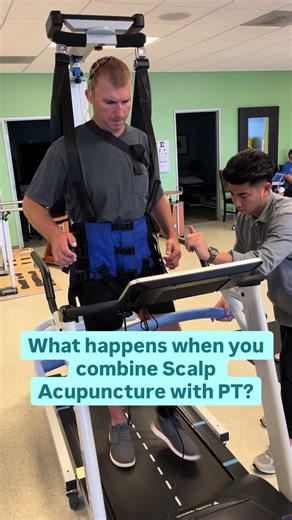 𝐒𝐜𝐚𝐥𝐩 𝐀𝐜𝐮𝐩𝐮𝐧𝐜𝐭𝐮𝐫𝐞 𝐏𝐡𝐲𝐬𝐢𝐜𝐚𝐥 𝐓𝐡𝐞𝐫𝐚𝐩𝐲: 𝐓𝐡𝐞 𝐏𝐨𝐰𝐞𝐫 𝐂𝐨𝐦𝐛𝐨 𝐟𝐨𝐫 𝐑𝐞𝐜𝐨𝐯𝐞𝐫𝐲! 🧠✨ Meet Greg, pushing boundaries on the treadmill, but look closer! Those tiny needles? That's Scalp Acupuncture in action! Recovery is all about the brain's ability to rewire itself (neuroplasticity). Scalp acupuncture acts as a powerful catalyst: ⚡️ It excites damaged brain regions, making them more active. 📈 It increases brain sensitivity & excitability, essentially putti