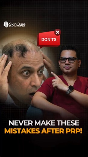 Never Make These Mistakes After Getting PRP Therapy! ⚠️ | Dr Jangid