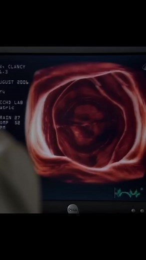 Dr. House found the problem on the movie theater screen...😳 | Cinema Home