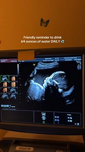 28K views · 23K reactions | Water is your bestie! 擄 #portlandultrasound #ultrasonafetalfotos #ultrasoundstudio #pregnancy #babyultrasound #ultrasound #vancouverwashington #portlandoregon #ultrasoundscan #vancouverultrasound #washingtonultrasound #pnwphotographer #pdx #pregnancy #ultrasoundstudio #3d4dscan #3d4dultrasound #3d4dstudio | Ultrasona Fetal Fotos - 3D/4D Prenatal Ultrasounds - Portland, Oregon | Facebook
