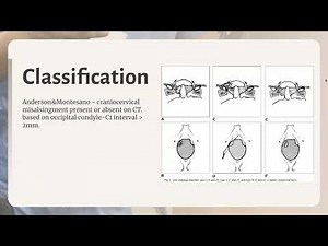 Occipital Condyle Fractures | Diagnosis, Management & Classification Simplified