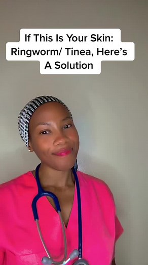 Ringworms are characterised by itchy, rings, raised borders. They slowly become bigger and bigger . Remember to wash and dry skin well before applying ointment. You can use any 1% Clotrimazole creams . This one is available at cliks and cheaper compared to others #ringworms #ringwormtreatment #skincondition #youngdoctors #skincaretips101 #southafrica🇿🇦