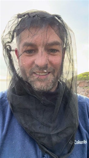 Scottish Midge Are Relentless ! #shortsfeed