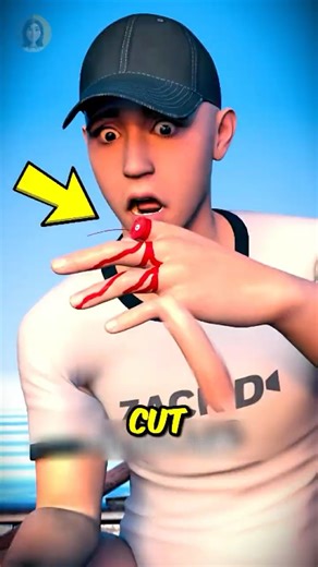 Can You Really Save A Lost Finger⁉️😱