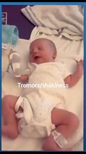 Understanding Hypoglycaemia in Newborns: A Mother's Journey