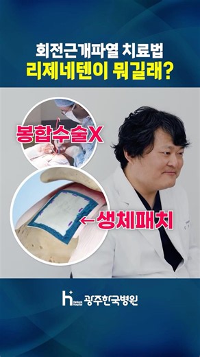 광주 어깨 회전근개파열 수술 / '리제네텐' 패치봉합술 #광주어깨수술 #회전근개수술 #광주정형외과