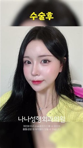 턱 하나로 미모 상승하는 법