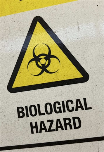 Understanding FIFO Work in the Mining Industry