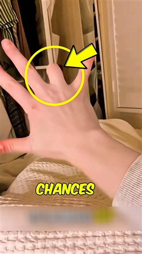If You Ever Cut Off a Finger… Do THIS Immediately to Save It 😨