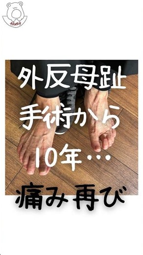 外反母趾の再手術はイヤ #外反母趾 #手術回避 #足の痛み