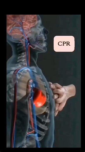 2.7K views · 195 reactions | CPR is a life-saving technique that is useful in many emergency situations where a person’s breathing or heartbeat has stopped. For example, when a person suffers a heart attack or almost drowns. The American Heart Association recommends starting CPR by performing quick, strong chest compressions. This Hands-Only CPR recommendation applies to both untrained people and first responders. | Medical Story Nepal | Facebook
