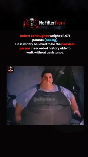 The Heaviest Person Who Could Still Walk 😳