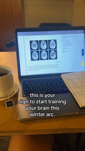 North Austin Neurofeedback on Instagram: "loading…winter brain reset era ❄️☃️ come visit us! link in bio 🙌🏼 #reelsvideo #healthyliving #healthylifestyle #mentalhealth #december #winter #mindset #selflove #holidays #holidayvibes #christmas #newyear #newyearnewyou"