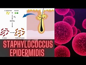 staphylococcus epidermidis (S. epidermidis ) ||Easy Microbiology