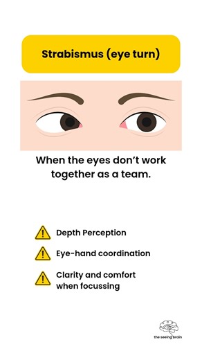 Down Syndrome and Eyes - #downsyndrome #eyehealth