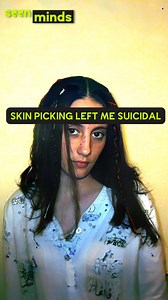 I Couldn't Stop Picking My Skin ‘I was super embarrassed of always trying to cover my body and of hiding.’ Angela struggled with a compulsion to pick at her face and body for up to 8 hours a day, facing the physical and emotional toll of this condition. She shares her journey with a rare impulse control disorder known as Dermatillomania, a skin picking disorder. | seen.tv