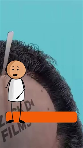 Brutal Scalp Surgery to Reduce Baldness