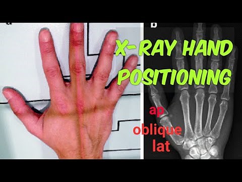 x ray hand positioning | x ray hand ap lateral view | x ray hand ap oblique | radiography lectures