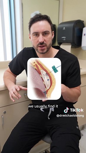 Cómo funcionan los expansores de tejido en reconstrucción