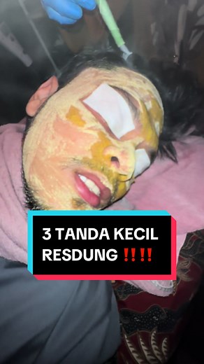 3 TANDA KECIL RESDUNG ‼️😎#nazaherbsbynazaanggun #foryou #trend #nazaanggun #viral #trending #fypシ #rawatanresdung #resdung #fyppppppppppppppppppppppp #kesihatan #kecantikan #healthy #beauty #carakampongcarakita #sin