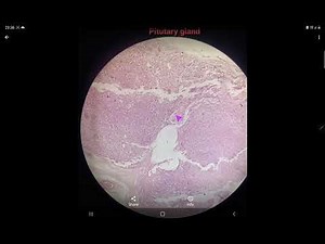 Histology of Pitutary(hypophysis cerebri) gland, slide identification and explanation