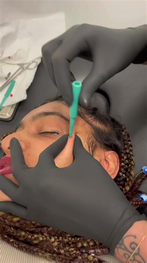 Skin Diver on the face #dermalpiercing #skindiver #piercing #enfieldtown #fyp