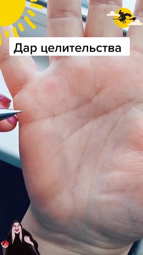 Exploring Hand Analysis Techniques for Dentists