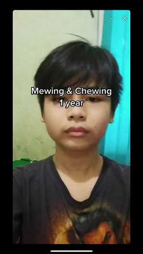 Mewing and chewing 1 year #fyp #mewing #chewing #jawline