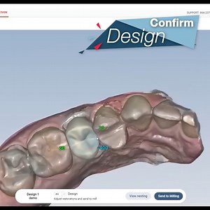 25 reactions | Did you know that glidewell.io™ comes bundled with our user-friendly fastdesign.io™ Software and Design Station? Just verify margins, confirm design and send to mill. Click, click, go! And you're done. Learn more about how simple digital dentistry can be by visiting https://glidewell.io/promotions/sm-q222 | Glidewell Dental | Facebook