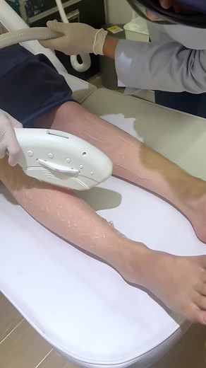 Korean Legs Treatment at Sozo Skin Clinic for Smooth and Glowing Skin