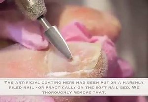 14K views · 33 reactions | how to remove dead toe nail  | Fashion | Facebook