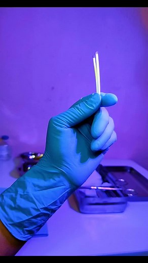 Efectos Secundarios del Implante Hormonal