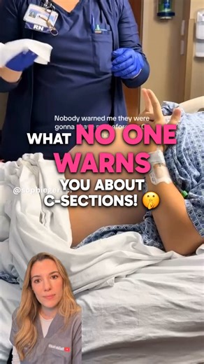 Dr Brooke Vandermolen MBBS BSc MRCOG | Shaving before a C‑section: do you actually need to? For most C‑sections, we only need a small clear area where the incision goes, not a... | Instagram