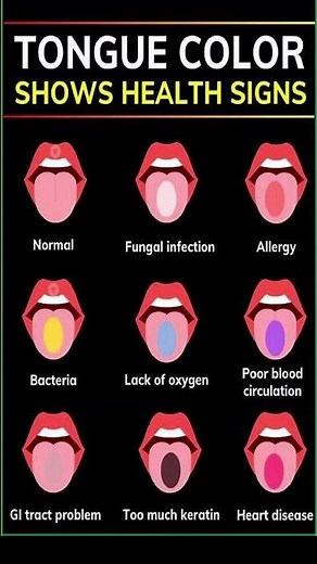 9 Tongue Signs That Reveal Your Hidden Health Issues