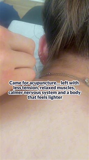 Tension down, breathing easier, muscles finally unclenched, and my whole system feels calmer and lighter. 😌💙 #choicehealthcentre #dartmouth #halifax #bedford #fallriver #novascotia #acupuncture | Choice Health Centre - Dartmouth