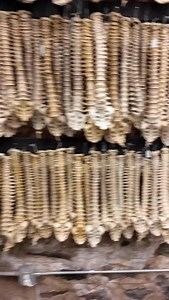 Step into a realm where history and science converge at The Bone Museum, located in the heart of Brooklyn, New York. Our latest video highlights some of our most captivating new additions: a new medical mount from Berlin, a human skull exhibiting signs of gigantism, a remarkable femur with a malunion fracture showing nearly five inches of displacement, and a torso displaying pronounced idiopathic scoliosis. These, alongside countless other extraordinary specimens, offer a profound glimpse into t