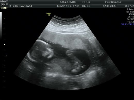 Katie Fuller on TikTok