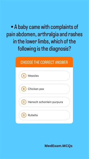 Medical Exam MCQs on Instagram: "Explanation: ⤵️ *Correct Answer is C 🔷 Henoch–Schönlein purpura (HSP) is an IgA-mediated small-vessel vasculitis, commonly seen in children. It classically presents with palpable purpura, abdominal pain, arthritis, and renal involvement. The condition is often self-limiting, but steroids are used in severe gastrointestinal or renal disease. #usmle #neetpg #medicine #medico #medical #medicalstudent #medicalschool #mbbs #fmge #aiims #inicet #doctor #nurse #medicin