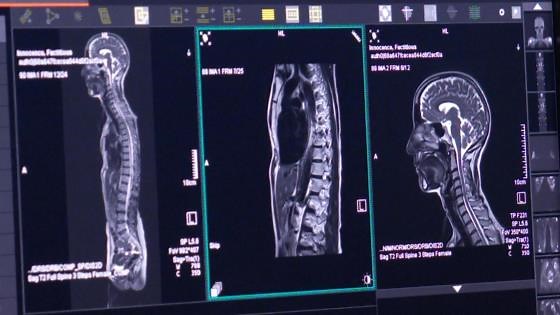Why are people having whole body MRI tests? Do they help?