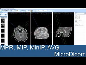 MicroDicom MPR — MIP, MinIP, AVG, Slab & 3D tools