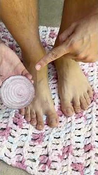 This Onion Trick Stops Joint Pain Overnight #NaturalSolution #HealthHacks #DIYHealing