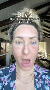 I’m hooked! CO2 skin resurfacing is going to be my yearly reset for my skin. This helps with fine lines and wrinkles, lightens hyperpigmentation, builds collagen and helps with overall skin quality and texture. The downtime is 5 to 7 days and so worth it! #skinhealth #skinresurfacing #beautytips #over40club | Lipsandlattes