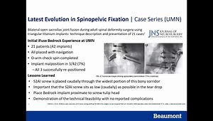 Role of SIJ in Lumbar Deformity