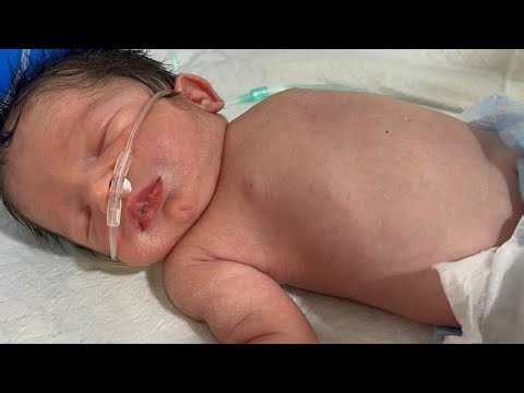 Newborn Baby Grunting – Watch This Important Sign 👶💔