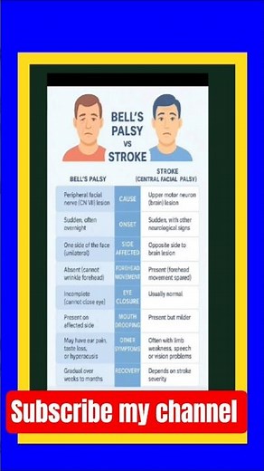 #Bell's palsy or Strock #Nursing #Nursing #shortsfeed