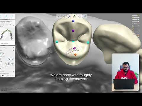 From Case Brief to Final Outcome: Inside a Complete Dental Design Workflow